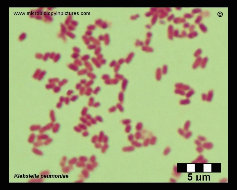 Klebsiella pneumoniae Gram stain